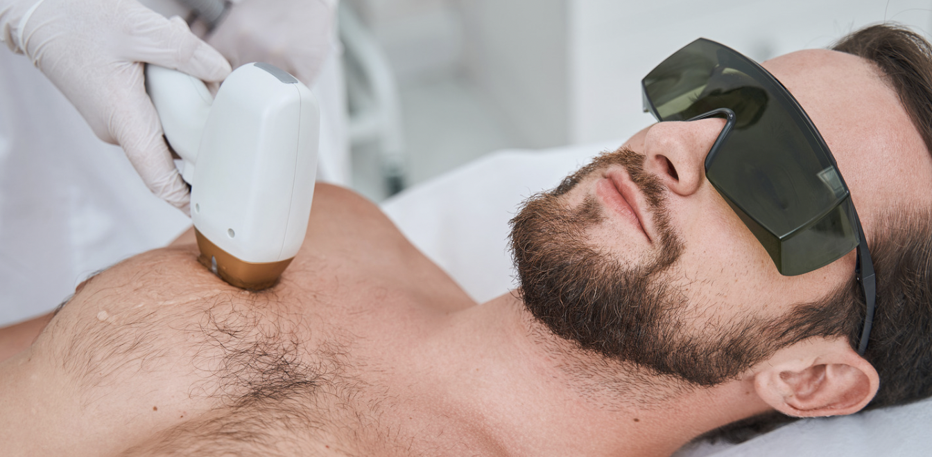 Laser Hair Removal for Men