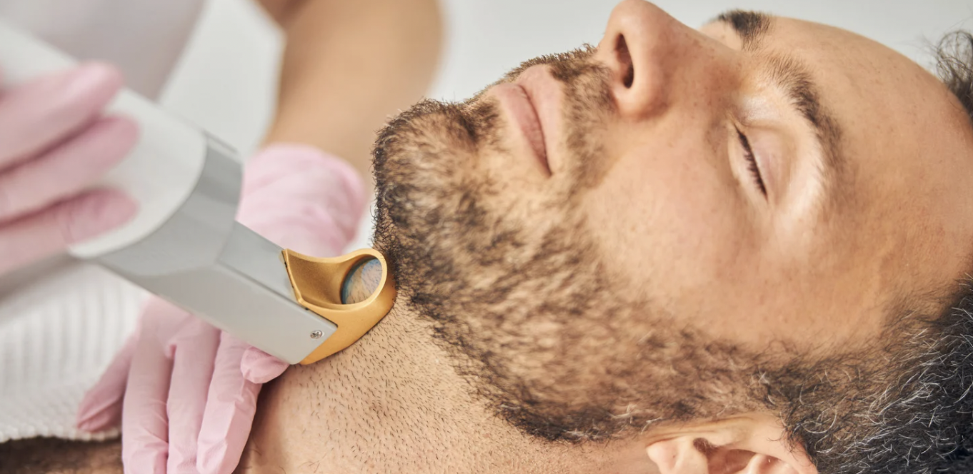 Laser Hair Removal for Men