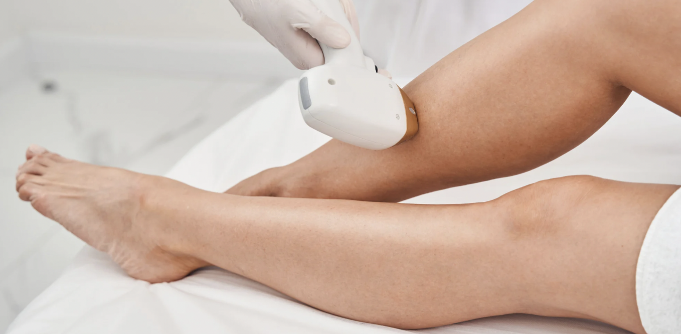 Laser Hair Removal for Indian Skin in Vienna