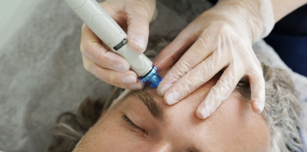 HydraFacial Results and Benefits Near Falls Church