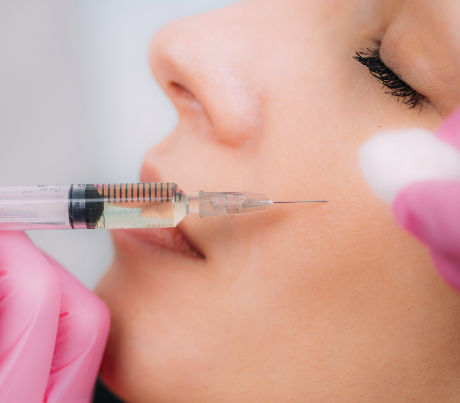 sculptra in mcclean