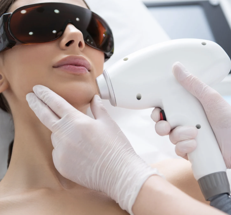 Laser Skin Tightening