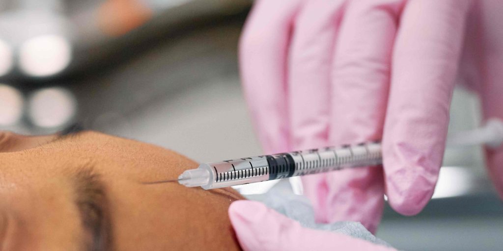 Botox Appointment for Forehead Lines in McLean Virginia