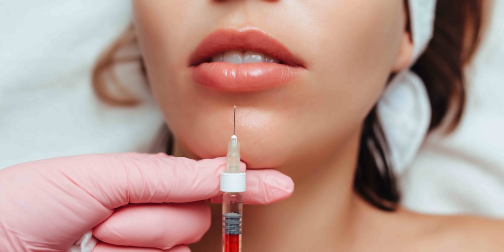 Lip Filler Consultation for Natural Volume and Definition