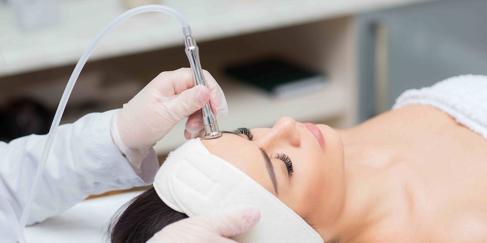 Microdermabrasion Consultation for Acne Scars and Uneven Texture