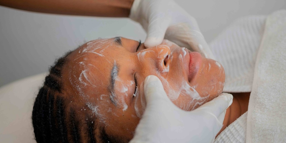 Acne Facial Appointments in McLean VA for Clearer and Healthier Looking Skin