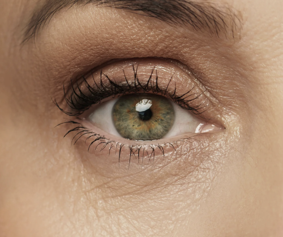 rf eye rejuvenation