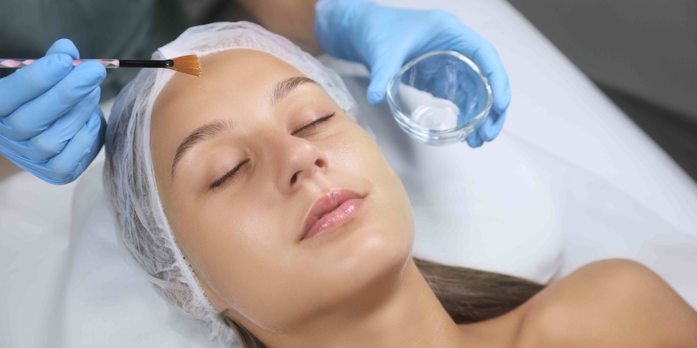 Chemical Peels For Acne Scars and Skin Texture in McLean VA