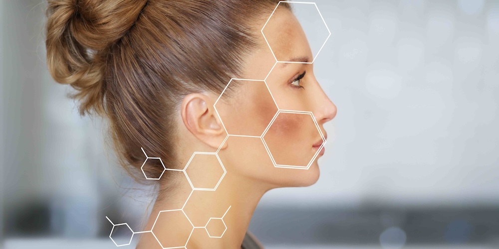 Hyperpigmentation and Melasma Treatment in Tysons Corner VA