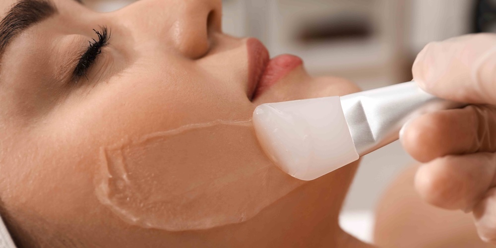 Chemical Peels for Acne Scars in McLean VA