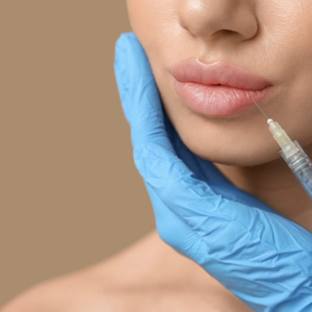 restylane kysse in tysons cornery virginia